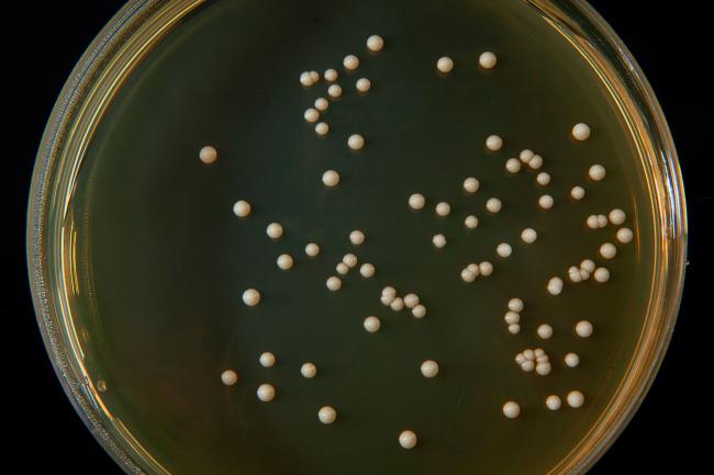 Saccharomyces cerevisiae on petri dish photographed against a black backdrop