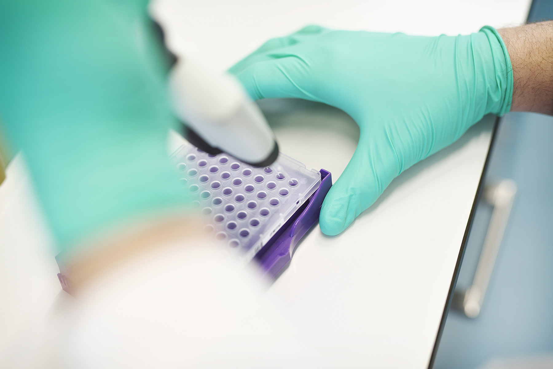 Prostate cancer urine test identifies good prognosis for patients Prostate cancer urine test identifies good prognosis for patients