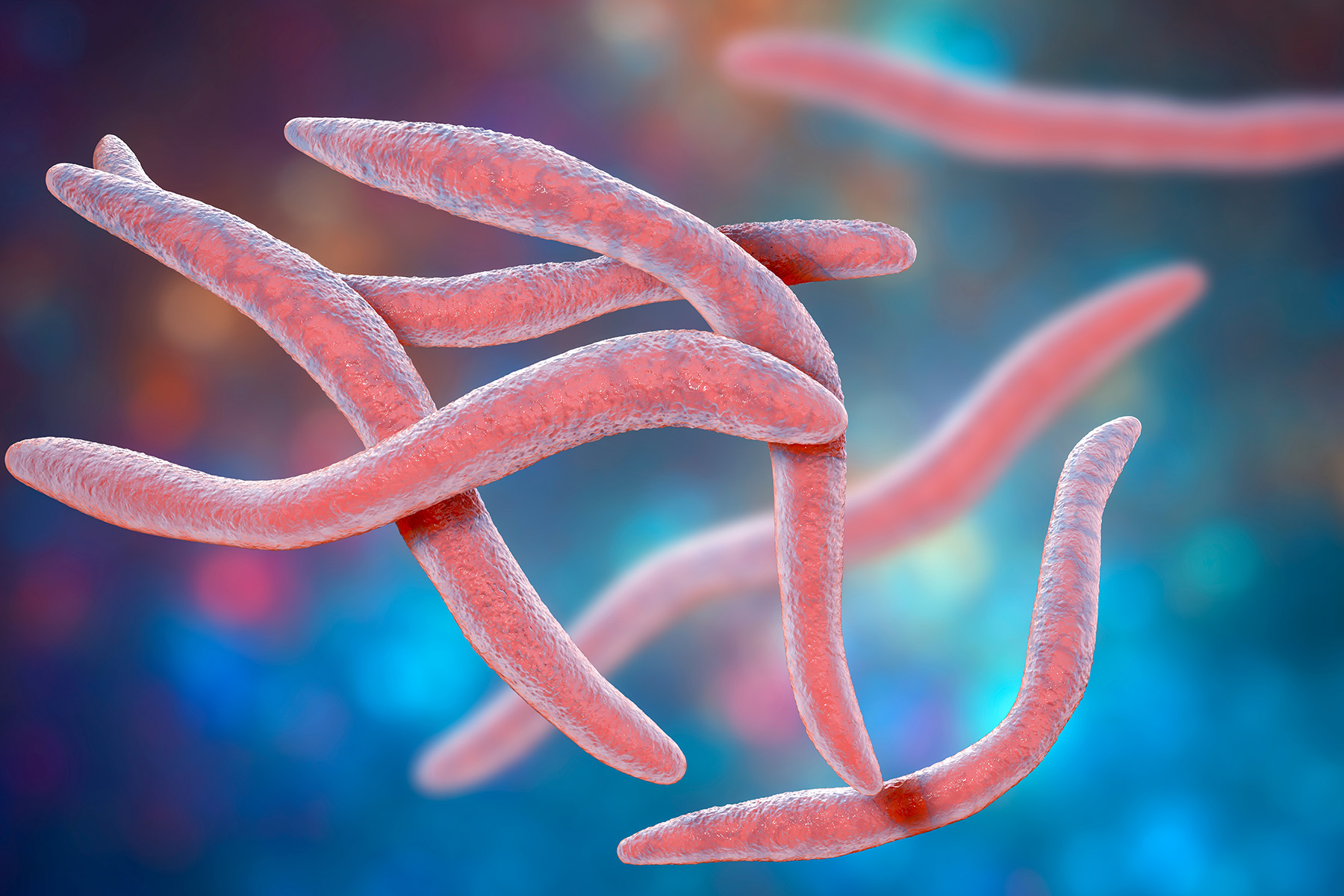 Five types of bacteria linked to aggressive prostate cancer Five types of bacteria linked to aggressive prostate cancer