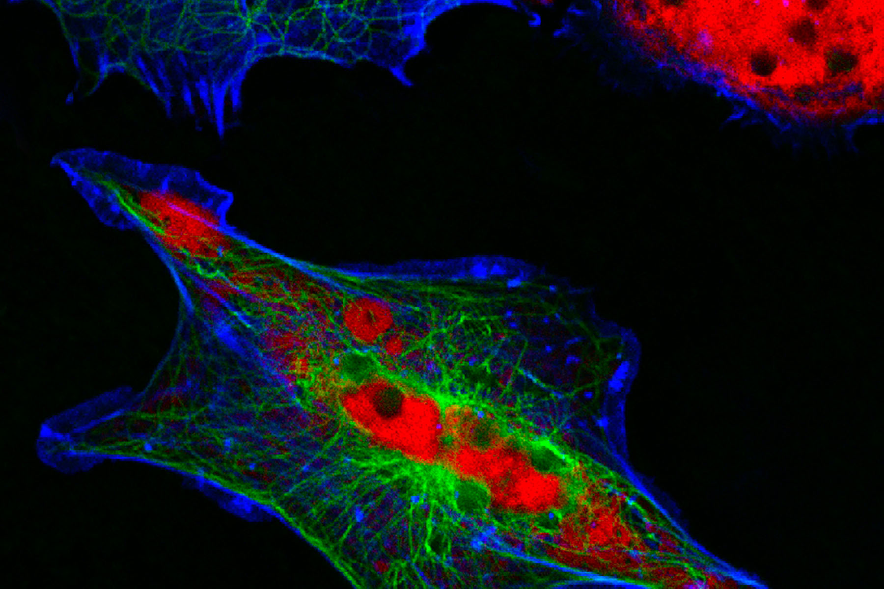 Calcium channels play such a vital role in cell signalling and neuronal function Calcium channels play such a vital role in cell signalling and neuronal function