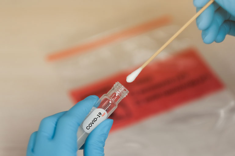 EI has been at the forefront of co-ordinating the expertise of the Norwich Research Park to increase COVID-19 testing capacity EI has been at the forefront of co-ordinating the expertise of the Norwich Research Park to increase COVID-19 testing capacity