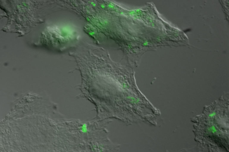 epithelial cells from a cultured human intestinal cell line (not an organoid) infected with Salmonella (green dots) epithelial cells from a cultured human intestinal cell line (not an organoid) infected with Salmonella (green dots)