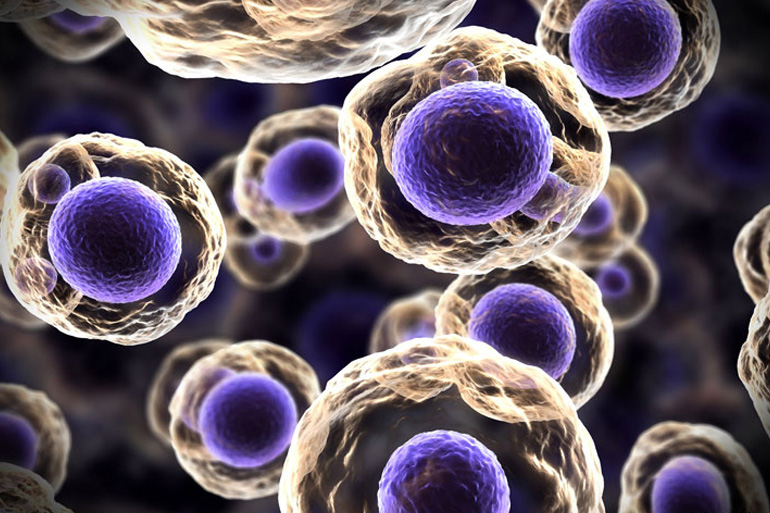 Autophagy - A review of techniques Autophagy - A review of techniques