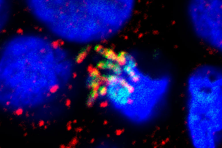Evolutionary arms race pits our cellular defence mechanisms against invading bacteria Evolutionary arms race pits our cellular defence mechanisms against invading bacteria