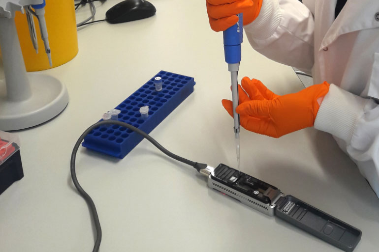 New rapid test diagnoses pneumonia and lower respiratory infections New rapid test diagnoses pneumonia and lower respiratory infections
