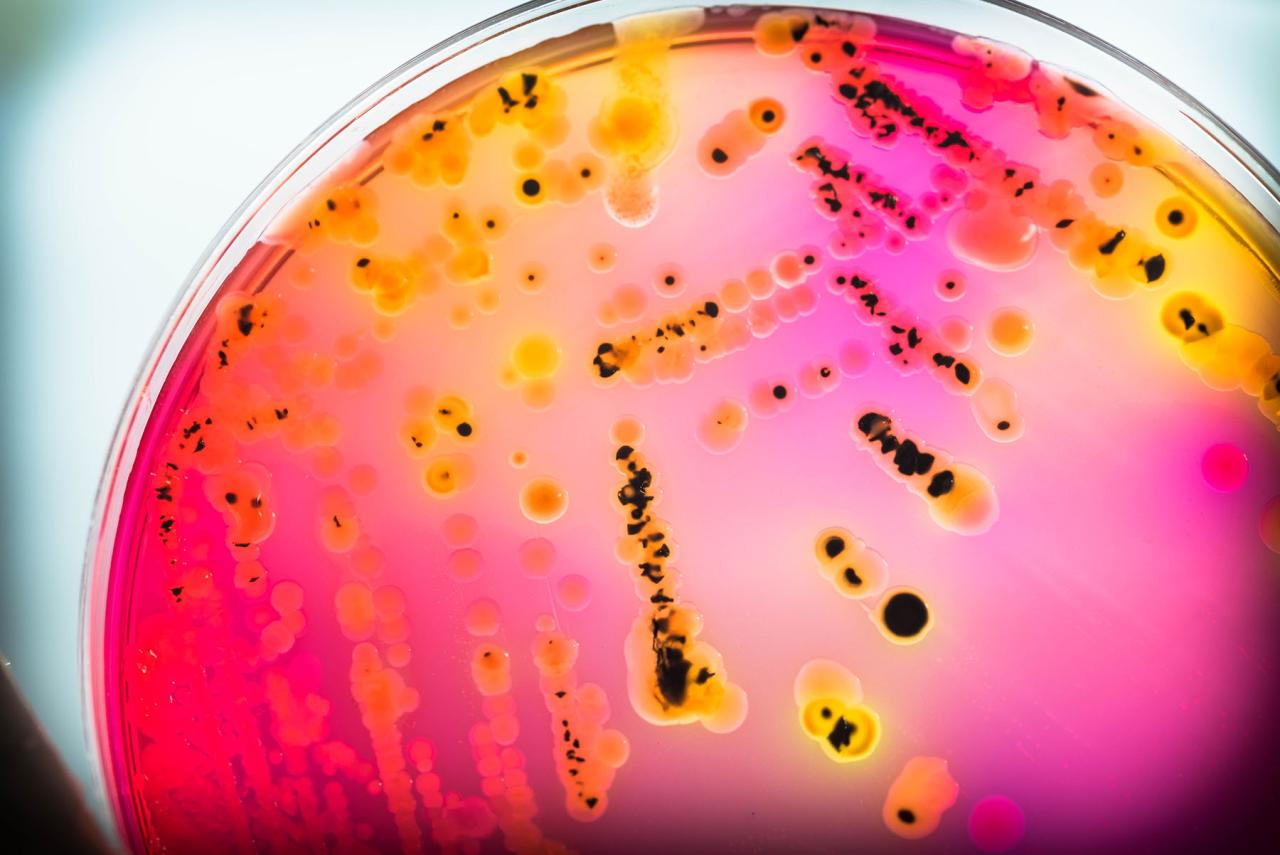 Bacterial colony on petri dish