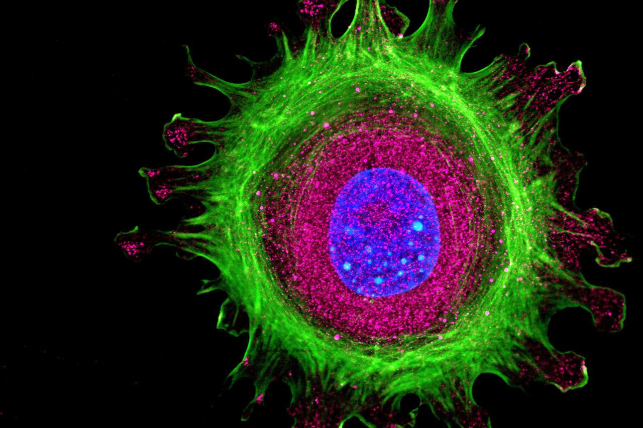 Immunofluorescence of single human cell stained grown in tissue culture