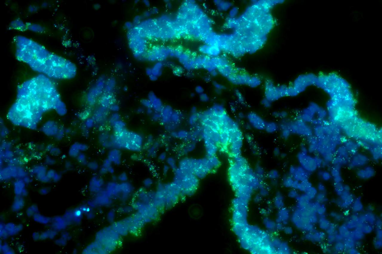 Spatial image of lung tissue