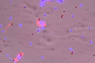 Stained cells under a microscope during a recent study from Dr Wojtowicz