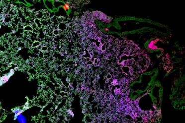 Spatially resolved image of lung tissue from Dr Sonia Fonseca at the Earlham Institute