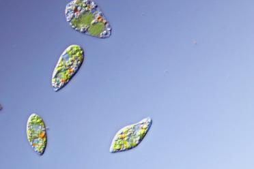 Euglena laciniata under the microscope