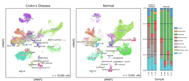 A UMAP plot showing intestinal cell map of normal and crohn's disease affected gut