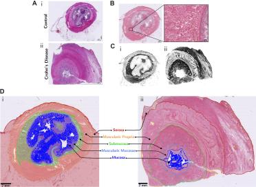 Annotated histology images of normal and crohn's disease affected ileum samples