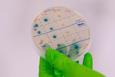 Scientist wearing green safety gloves holds an agar plate