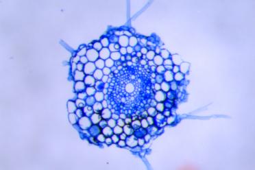 30 micrometre cross-sections of wheat roots