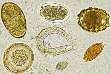 Sex cells helminths