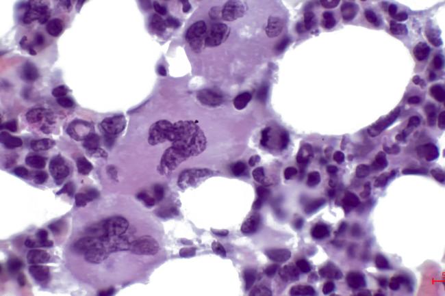 Light micrograph of a section through bone marrow tissue. It consists mainly of haematopoietic tissue, where blood cells are created. In the center are three megakaryocytes.