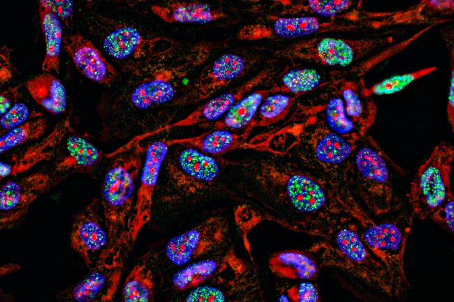 fluorescence microscopic view of cancer cells in culture