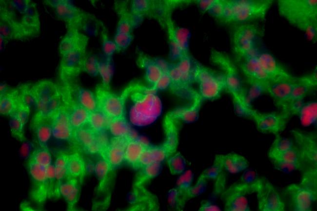 Spatially resolved image of lung tissue from Dr Sonia Fonseca at the Earlham Institute