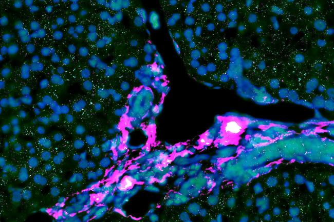 Spatial image of a liver biopsy through the Vizgen MERSCOPE platform